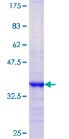 ab161890 on a 12.5% SDS-PAGE stained with Coomassie Blue.
