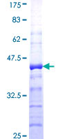ab161350 on a 12.5% SDS-PAGE stained with Coomassie Blue.