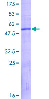 ab166174 on a 12.5% SDS-PAGE stained with Coomassie Blue.
