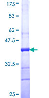 ab160287 on a 12.5% SDS-PAGE stained with Coomassie Blue.