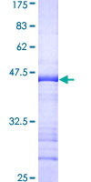 ab160846 on a 12.5% SDS-PAGE stained with Coomassie Blue.