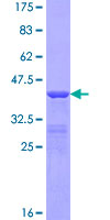 ab158749 on a 12.5% SDS-PAGE stained with Coomassie Blue.