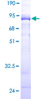 ab161311 on a 12.5% SDS-PAGE stained with Coomassie Blue.
