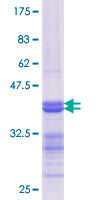 ab161026 on a 12.5% SDS-PAGE stained with Coomassie Blue.