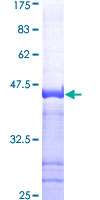 ab159623 on a 12.5% SDS-PAGE stained with Coomassie Blue.
