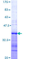 ab161671 on a 12.5% SDS-PAGE stained with Coomassie Blue.