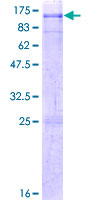 ab161318 on a 12.5% SDS-PAGE stained with Coomassie Blue.