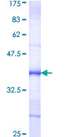 ab161319 on a 12.5% SDS-PAGE stained with Coomassie Blue.