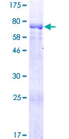 ab161582 on a 12.5% SDS-PAGE stained with Coomassie Blue.
