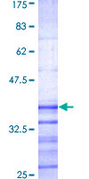 ab162322 on a 12.5% SDS-PAGE stained with Coomassie Blue.