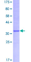 ab158781 on a 12.5% SDS-PAGE stained with Coomassie Blue.