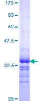 ab158782 on a 12.5% SDS-PAGE stained with Coomassie Blue.