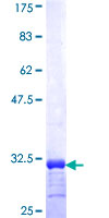 ab160752 on a 12.5% SDS-PAGE stained with Coomassie Blue.