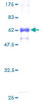 ab158784 on a 12.5% SDS-PAGE stained with Coomassie Blue.