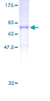 ab164313 on a 12.5% SDS-PAGE stained with Coomassie Blue.