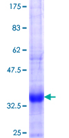 ab164314 on a 12.5% SDS-PAGE stained with Coomassie Blue.