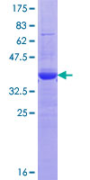 ab164809 on a 12.5% SDS-PAGE stained with Coomassie Blue.