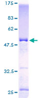 ab164260 on a 12.5% SDS-PAGE stained with Coomassie Blue.