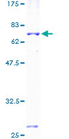 ab158787 on a 12.5% SDS-PAGE stained with Coomassie Blue.