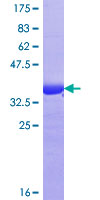 ab158786 on a 12.5% SDS-PAGE stained with Coomassie Blue.
