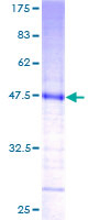 ab153296 on a 12.5% SDS-PAGE stained with Coomassie Blue.