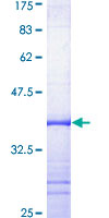 ab158789 on a 12.5% SDS-PAGE stained with Coomassie Blue.