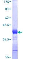 ab152953 on a 12.5% SDS-PAGE stained with Coomassie Blue.