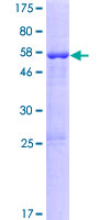 ab166141 on a 12.5% SDS-PAGE stained with Coomassie Blue.