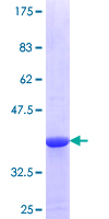 ab166142 on a 12.5% SDS-PAGE stained with Coomassie Blue.
