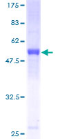 ab166395 on a 12.5% SDS-PAGE stained with Coomassie Blue.