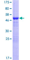 ab165868 on a 12.5% SDS-PAGE stained with Coomassie Blue.