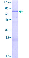 ab165682 on a 12.5% SDS-PAGE stained with Coomassie Blue.