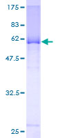 ab162841 on a 12.5% SDS-PAGE stained with Coomassie Blue.