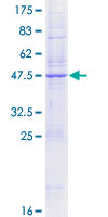 ab153142 on a 12.5% SDS-PAGE stained with Coomassie Blue.