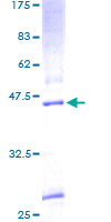 ab161242 on a 12.5% SDS-PAGE stained with Coomassie Blue.
