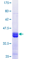 ab164635 on a 12.5% SDS-PAGE stained with Coomassie Blue.