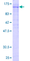 ab159892 on a 12.5% SDS-PAGE stained with Coomassie Blue.