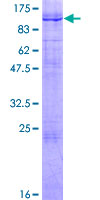 ab159893 on a 12.5% SDS-PAGE stained with Coomassie Blue.