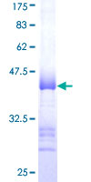 ab159894 on a 12.5% SDS-PAGE stained with Coomassie Blue.