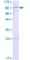 ab165896 on a 12.5% SDS-PAGE stained with Coomassie Blue.