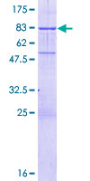 ab161097 on a 12.5% SDS-PAGE stained with Coomassie Blue.