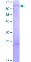 ab160721 on a 12.5% SDS-PAGE stained with Coomassie Blue.