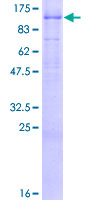 ab160690 on a 12.5% SDS-PAGE stained with Coomassie Blue.