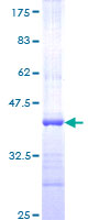 ab160691 on a 12.5% SDS-PAGE stained with Coomassie Blue.