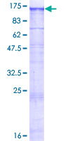 ab164162 on a 12.5% SDS-PAGE stained with Coomassie Blue.
