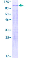 ab161610 on a 12.5% SDS-PAGE stained with Coomassie Blue.