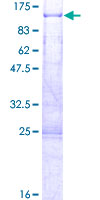 ab160663 on a 12.5% SDS-PAGE stained with Coomassie Blue.