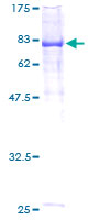 ab161525 on a 12.5% SDS-PAGE stained with Coomassie Blue.