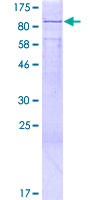 ab162607 on a 12.5% SDS-PAGE stained with Coomassie Blue.