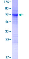 ab163515 on a 12.5% SDS-PAGE stained with Coomassie Blue.